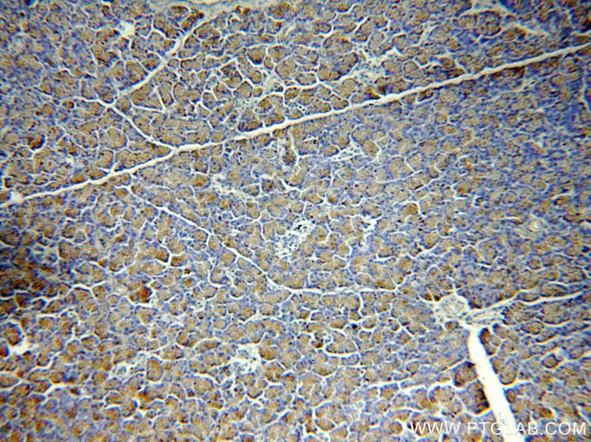 CEPT1 Antibody in Immunohistochemistry (Paraffin) (IHC (P))