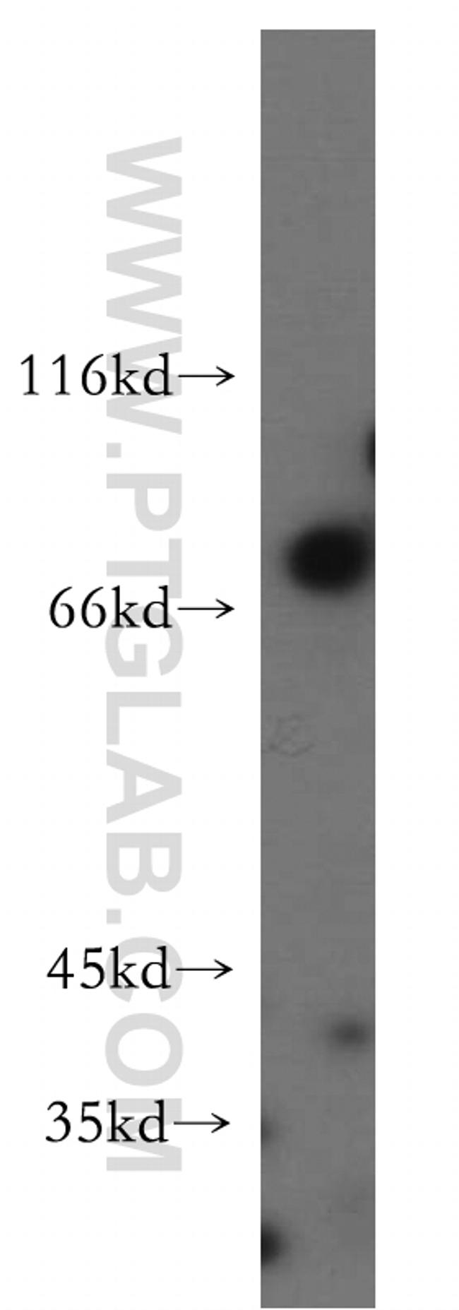 EIF2AK1 Antibody in Western Blot (WB)