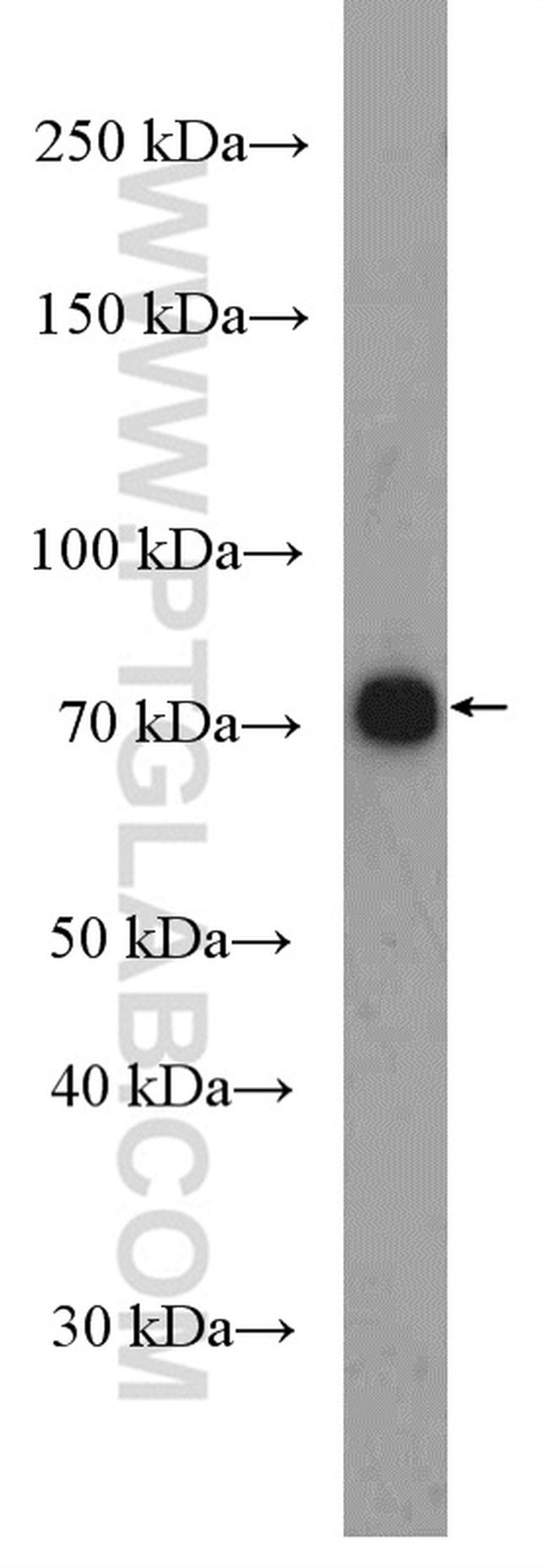 SLC11A2 Antibody in Western Blot (WB)