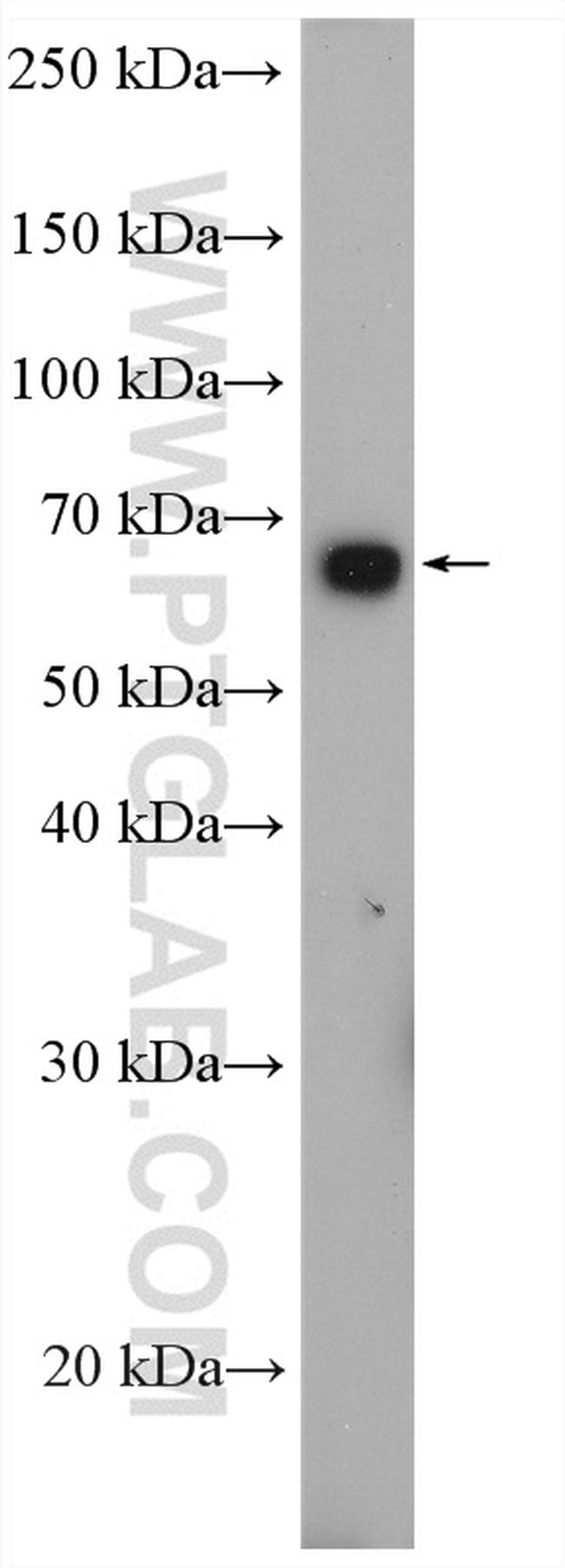 SLC11A2 Antibody in Western Blot (WB)