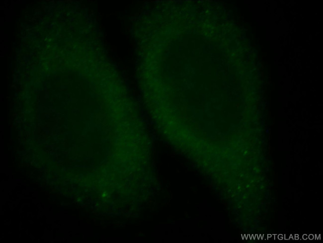 WDR6 Antibody in Immunocytochemistry (ICC/IF)