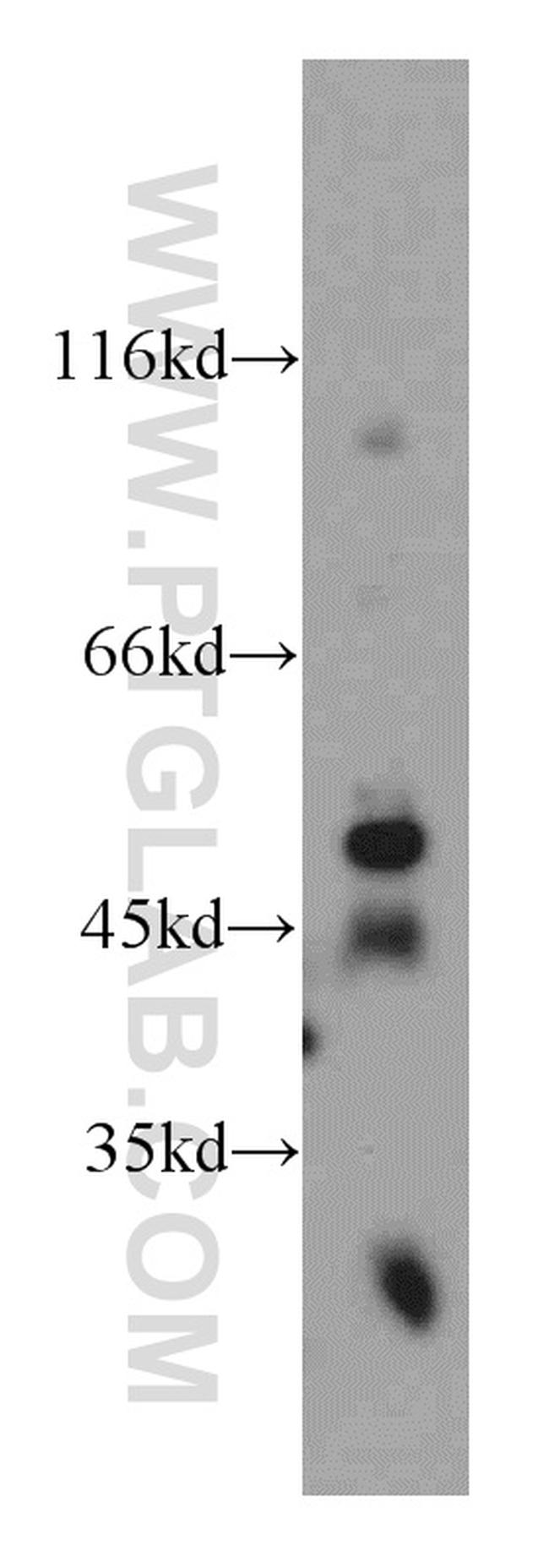 WIPF2 Antibody in Western Blot (WB)