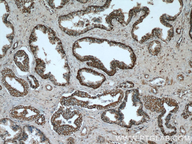 SPON2 Antibody in Immunohistochemistry (Paraffin) (IHC (P))