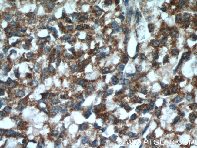 SPON2 Antibody in Immunohistochemistry (Paraffin) (IHC (P))