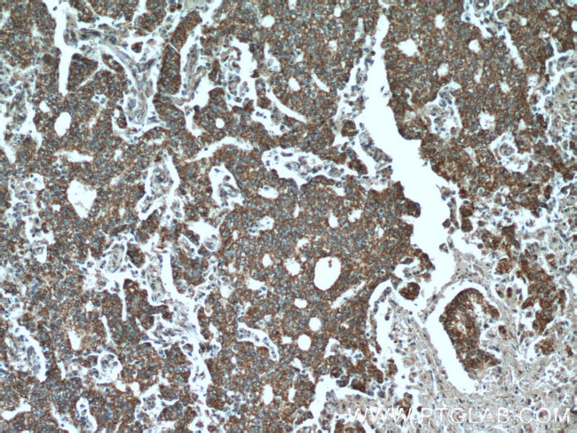 SPON2 Antibody in Immunohistochemistry (Paraffin) (IHC (P))