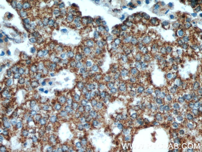 SPON2 Antibody in Immunohistochemistry (Paraffin) (IHC (P))