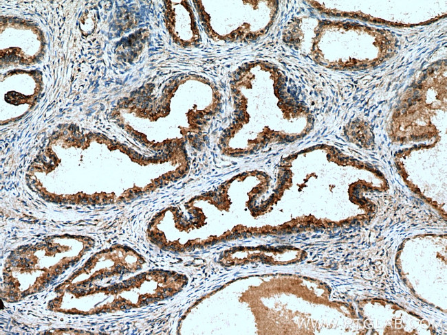 SPON2 Antibody in Immunohistochemistry (Paraffin) (IHC (P))