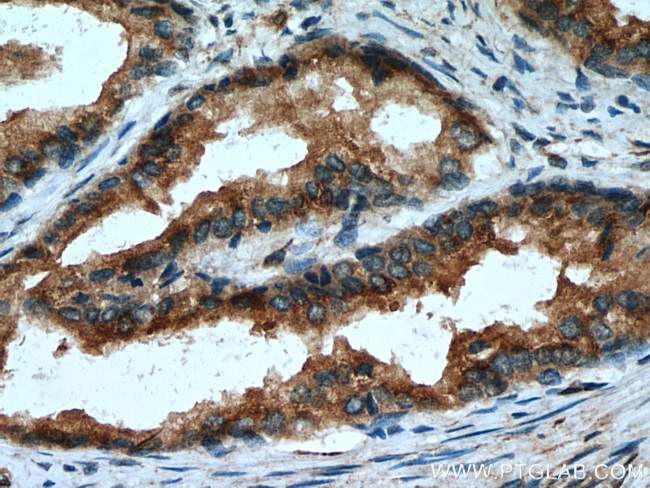 SPON2 Antibody in Immunohistochemistry (Paraffin) (IHC (P))