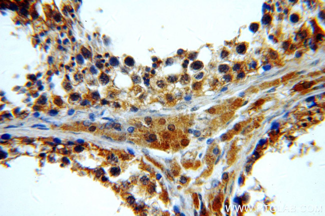 BTG4 Antibody in Immunohistochemistry (Paraffin) (IHC (P))