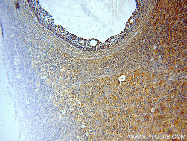 BTG4 Antibody in Immunohistochemistry (Paraffin) (IHC (P))