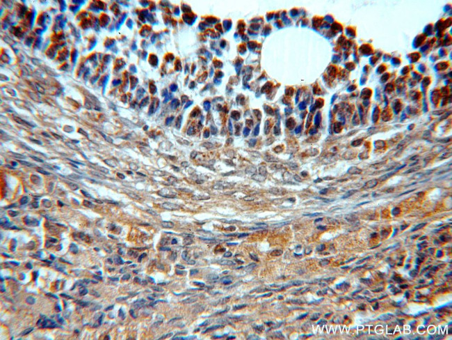 BTG4 Antibody in Immunohistochemistry (Paraffin) (IHC (P))