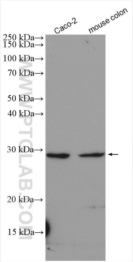 BTG4 Antibody in Western Blot (WB)