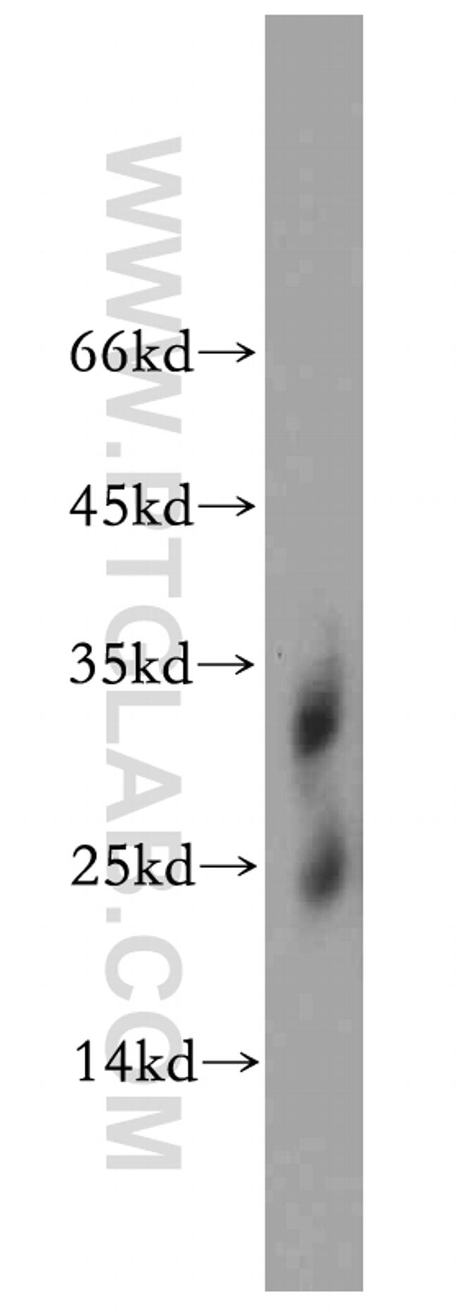 BTG4 Antibody in Western Blot (WB)