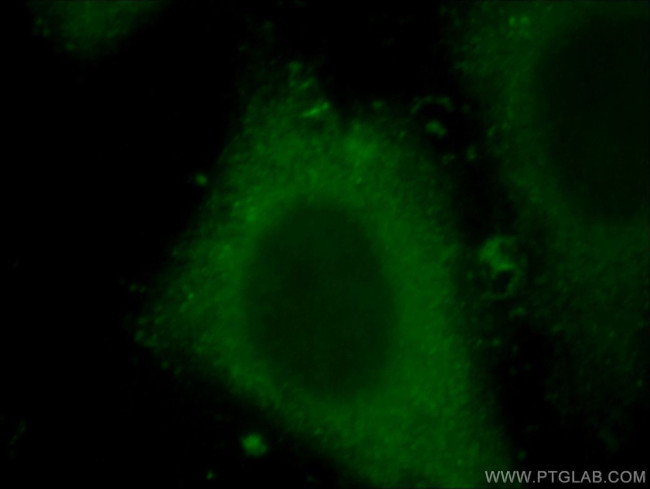 IL20RB Antibody in Immunocytochemistry (ICC/IF)