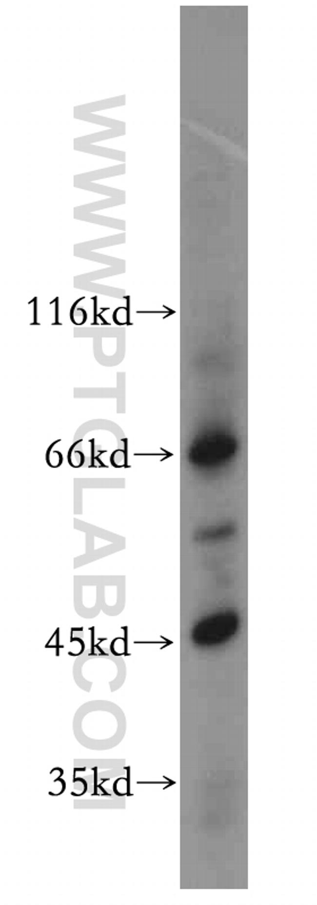 IL20RB Antibody in Western Blot (WB)