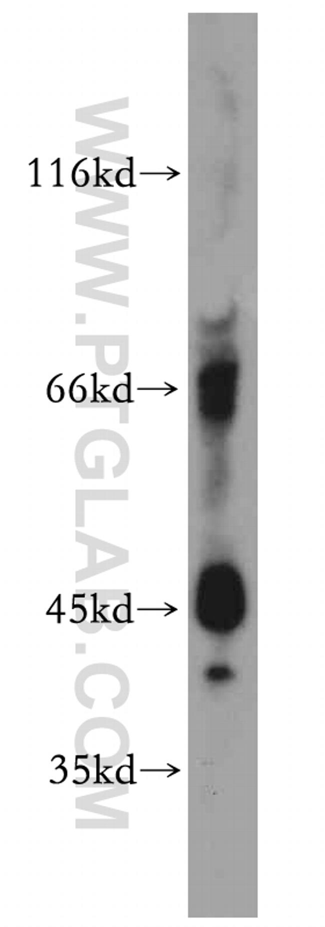 IL20RB Antibody in Western Blot (WB)