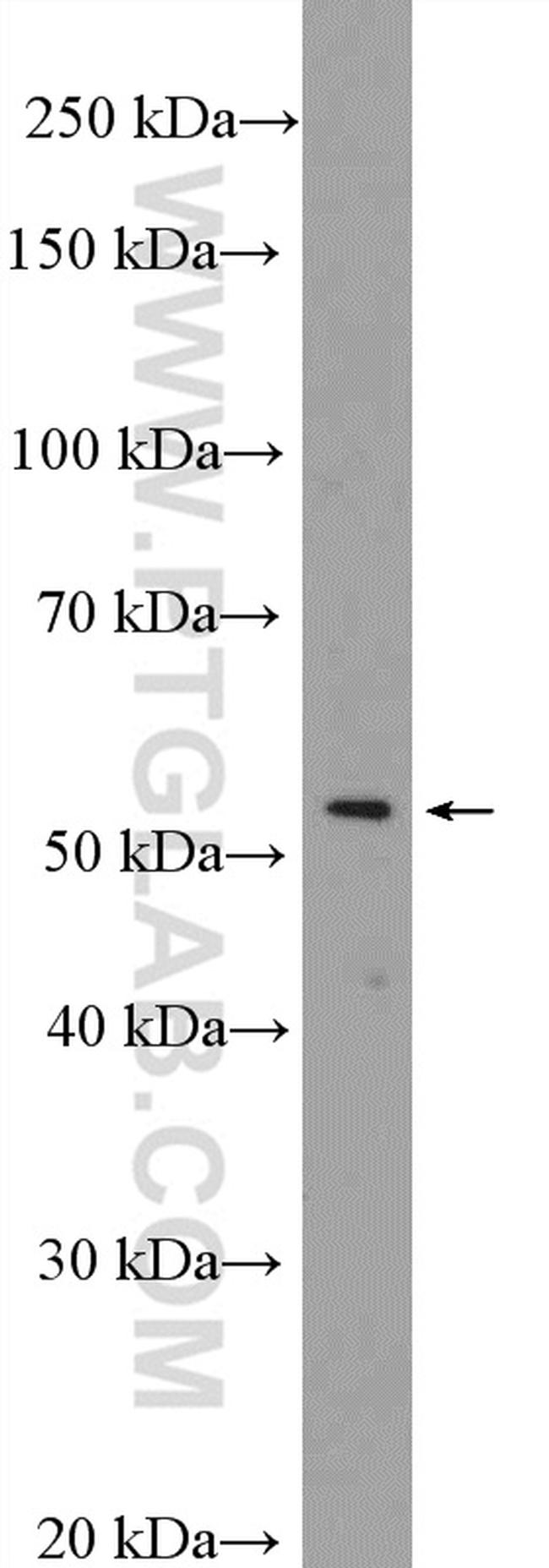 DDX49 Antibody in Western Blot (WB)