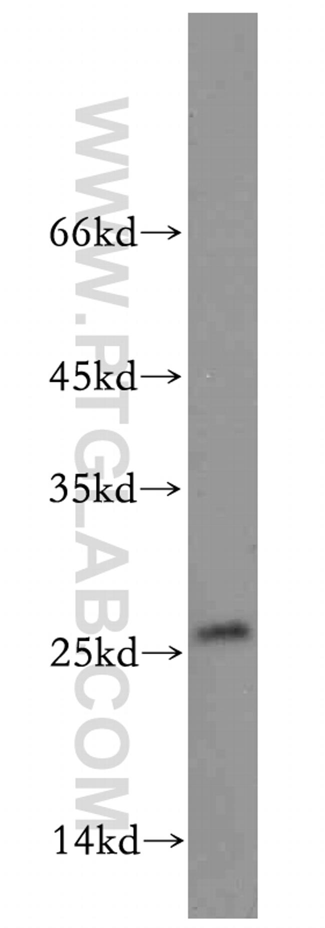 EIF1AD Antibody in Western Blot (WB)