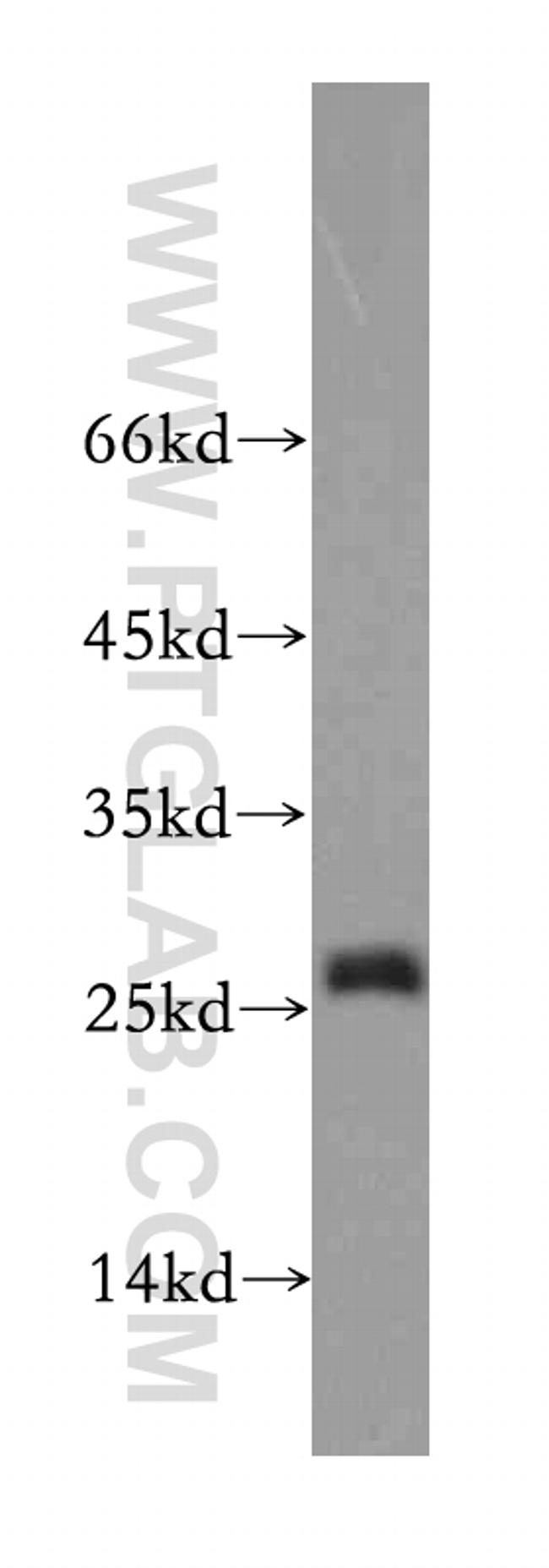 EIF1AD Antibody in Western Blot (WB)