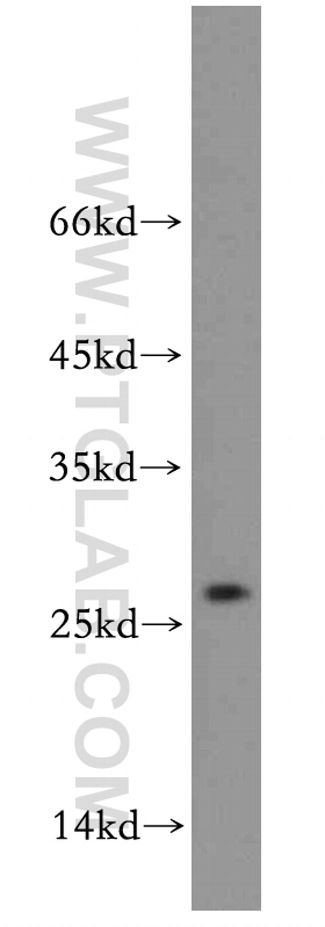EIF1AD Antibody in Western Blot (WB)