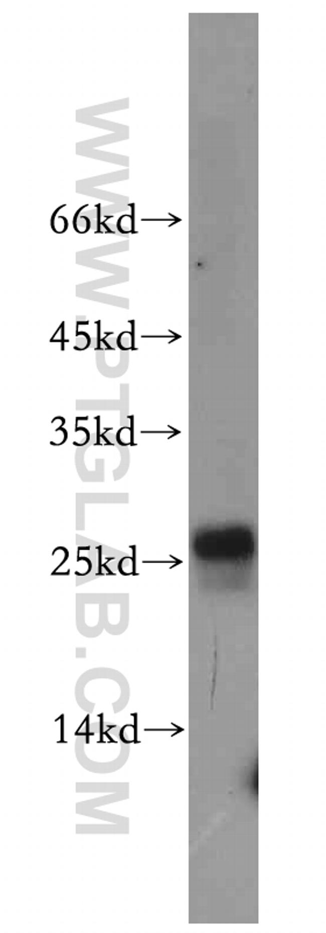 EIF1AD Antibody in Western Blot (WB)