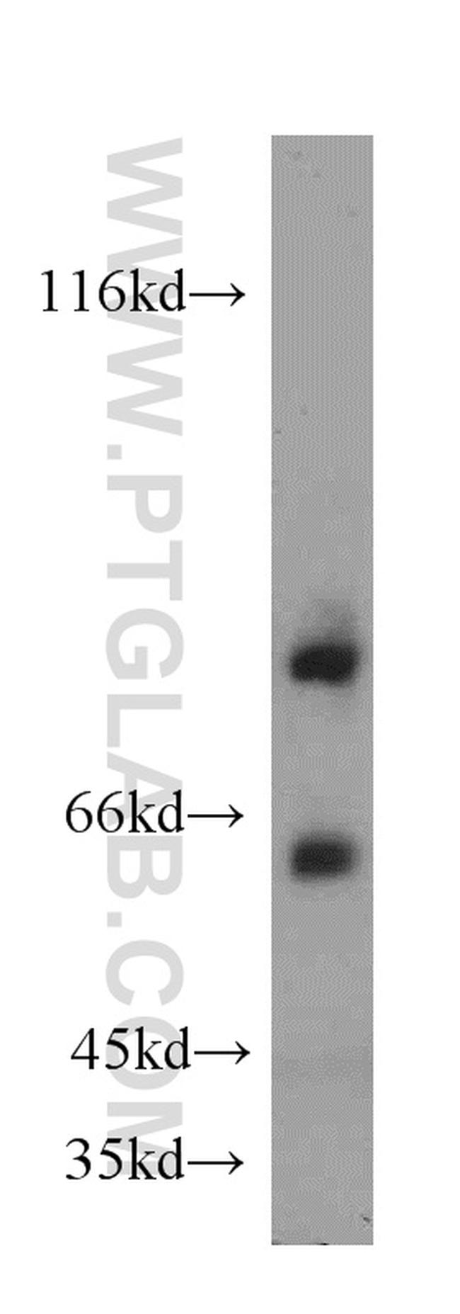 FOXP2 Antibody in Western Blot (WB)