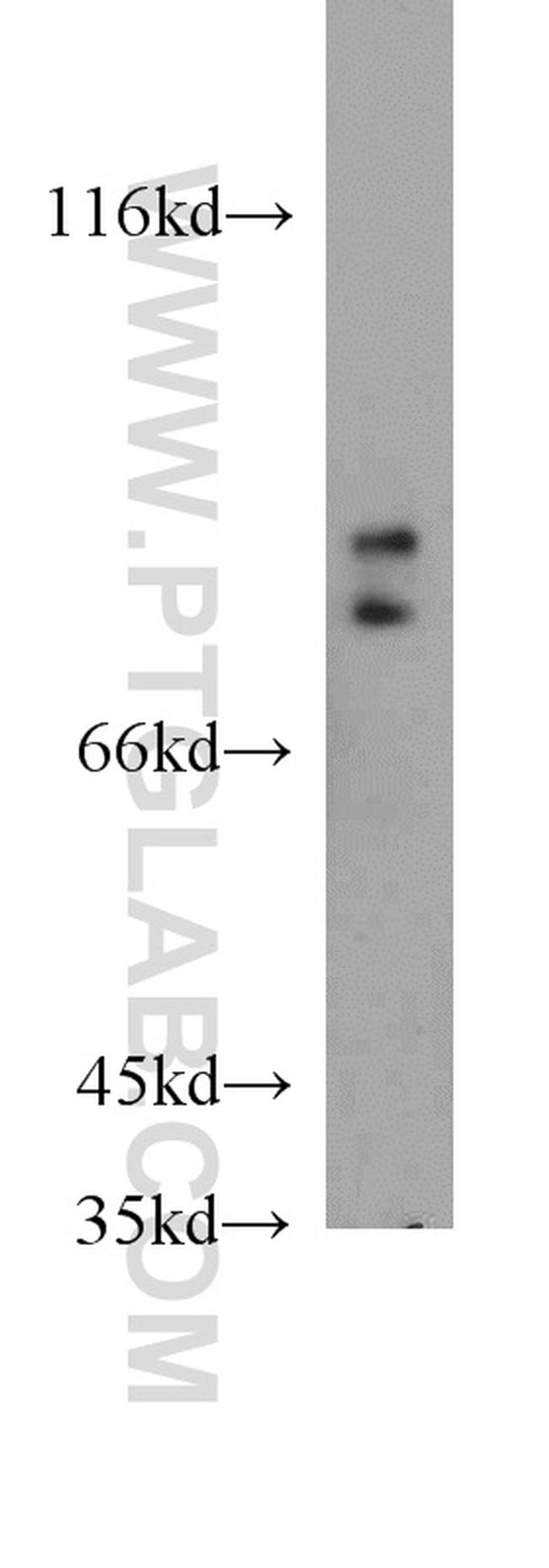 FOXP2 Antibody in Western Blot (WB)