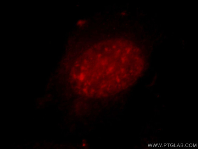 ZXDC Antibody in Immunocytochemistry (ICC/IF)