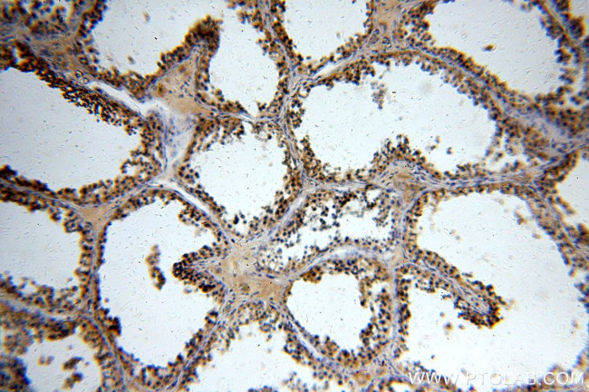 RUNDC3A Antibody in Immunohistochemistry (Paraffin) (IHC (P))