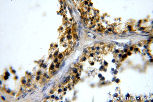 RUNDC3A Antibody in Immunohistochemistry (Paraffin) (IHC (P))