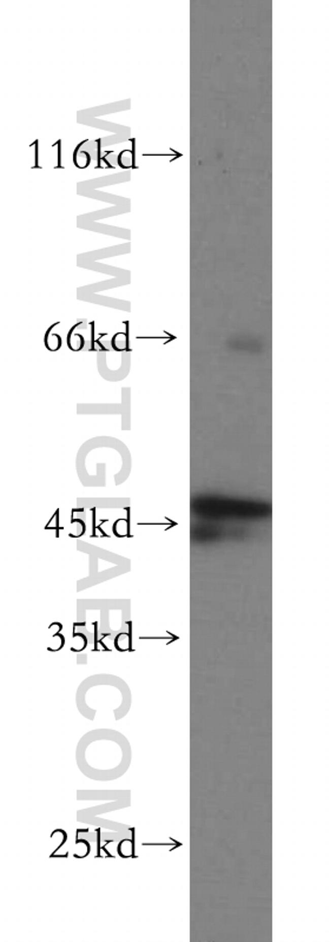 RUNDC3A Antibody in Western Blot (WB)