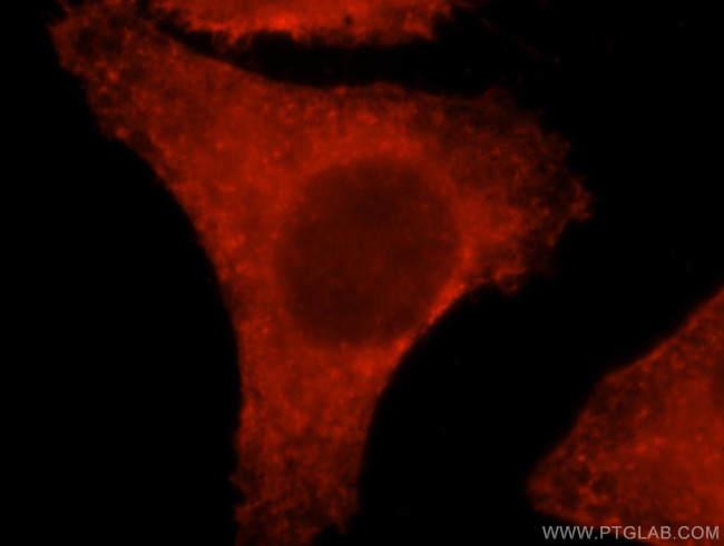 beta Actin Antibody in Immunocytochemistry (ICC/IF)