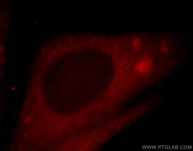 ZNF839 Antibody in Immunocytochemistry (ICC/IF)