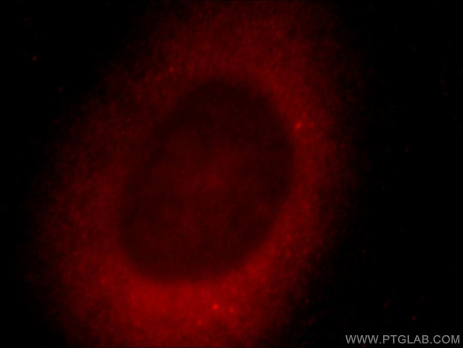 ZNF839 Antibody in Immunocytochemistry (ICC/IF)