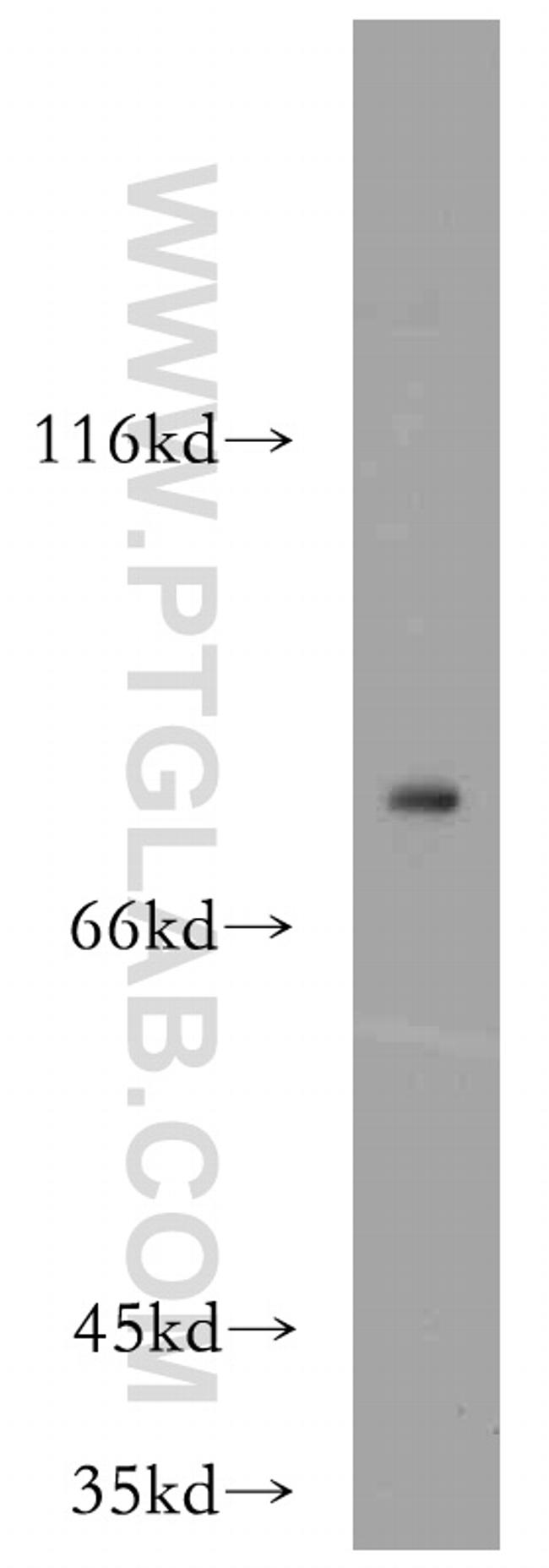 ZNF839 Antibody in Western Blot (WB)