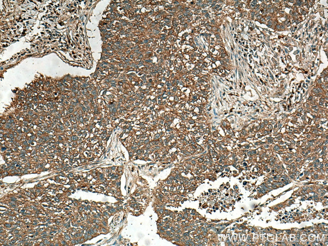 AXIN2 Antibody in Immunohistochemistry (Paraffin) (IHC (P))