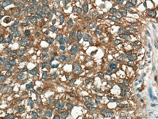 AXIN2 Antibody in Immunohistochemistry (Paraffin) (IHC (P))