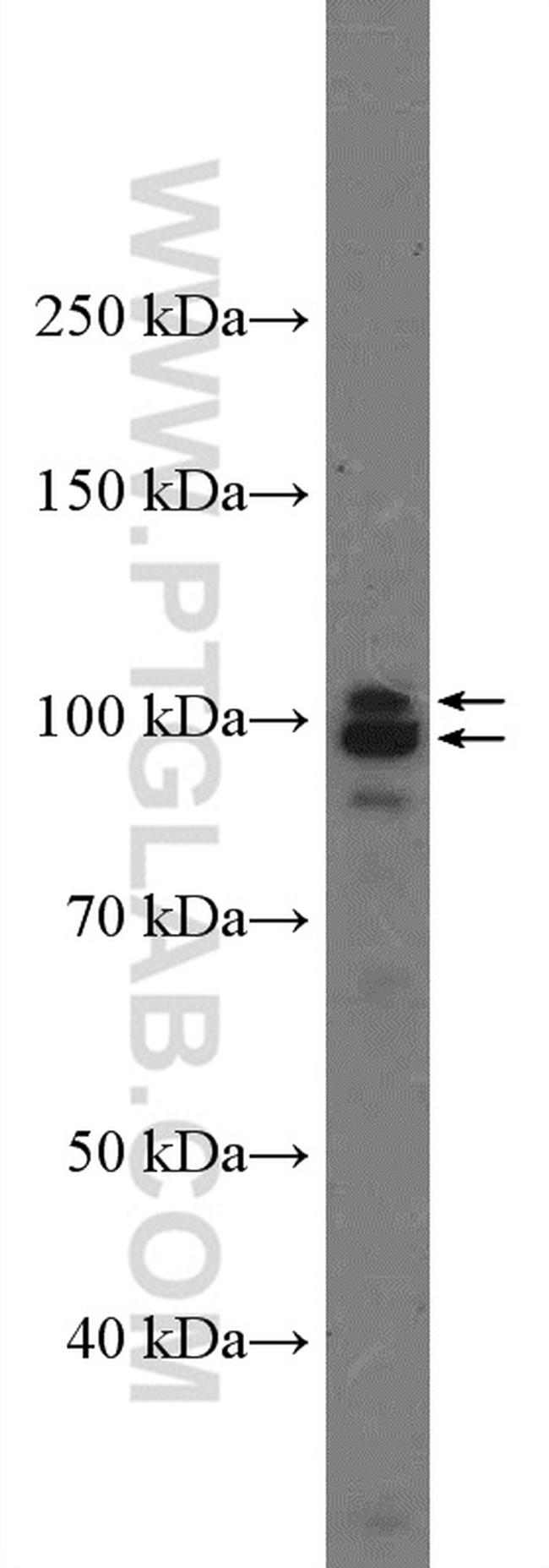 AXIN2 Antibody in Western Blot (WB)