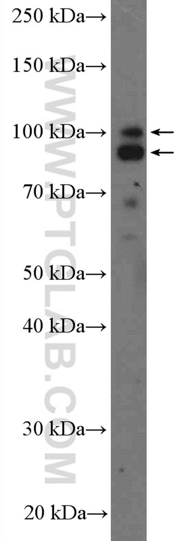 AXIN2 Antibody in Western Blot (WB)