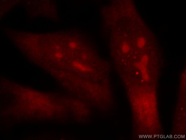 TOP2B Antibody in Immunocytochemistry (ICC/IF)