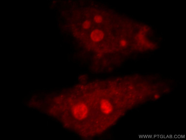 TOP2B Antibody in Immunocytochemistry (ICC/IF)