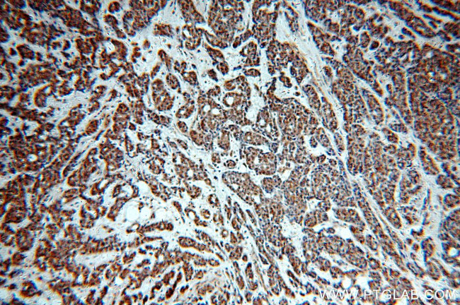 TOP2B Antibody in Immunohistochemistry (Paraffin) (IHC (P))