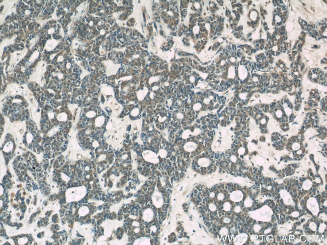 TOP2B Antibody in Immunohistochemistry (Paraffin) (IHC (P))