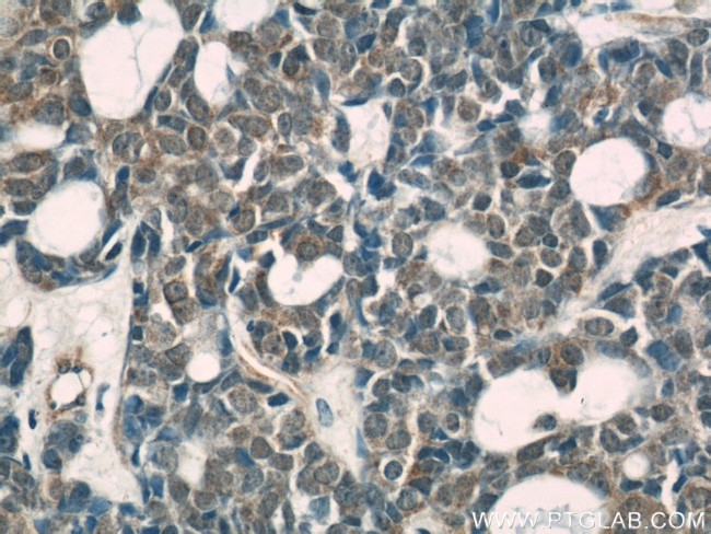 TOP2B Antibody in Immunohistochemistry (Paraffin) (IHC (P))