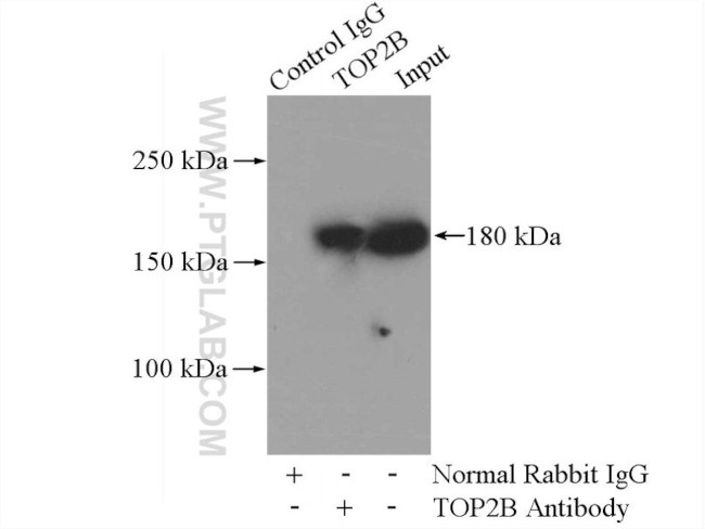 TOP2B Antibody in Immunoprecipitation (IP)