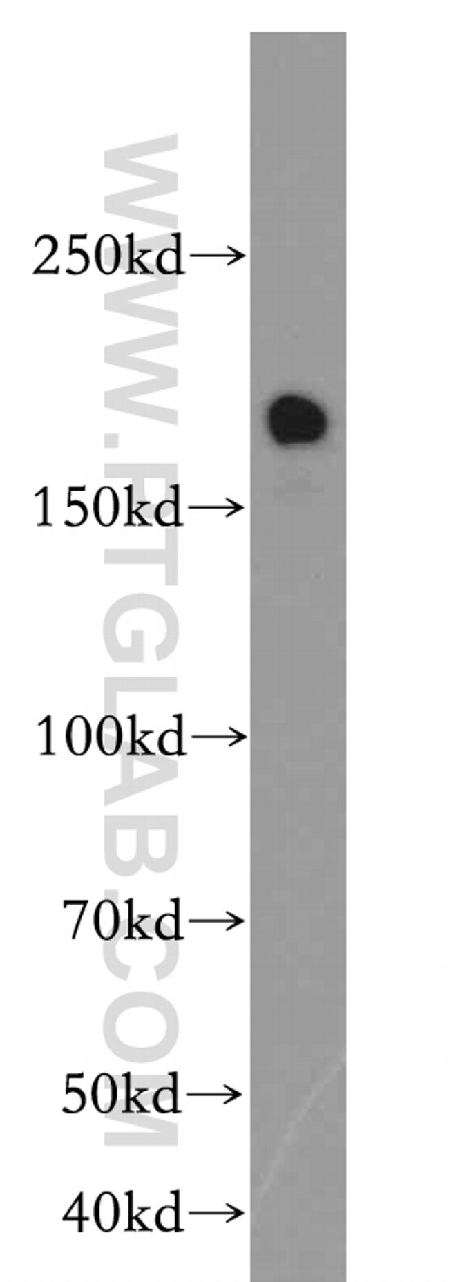 TOP2B Antibody in Western Blot (WB)