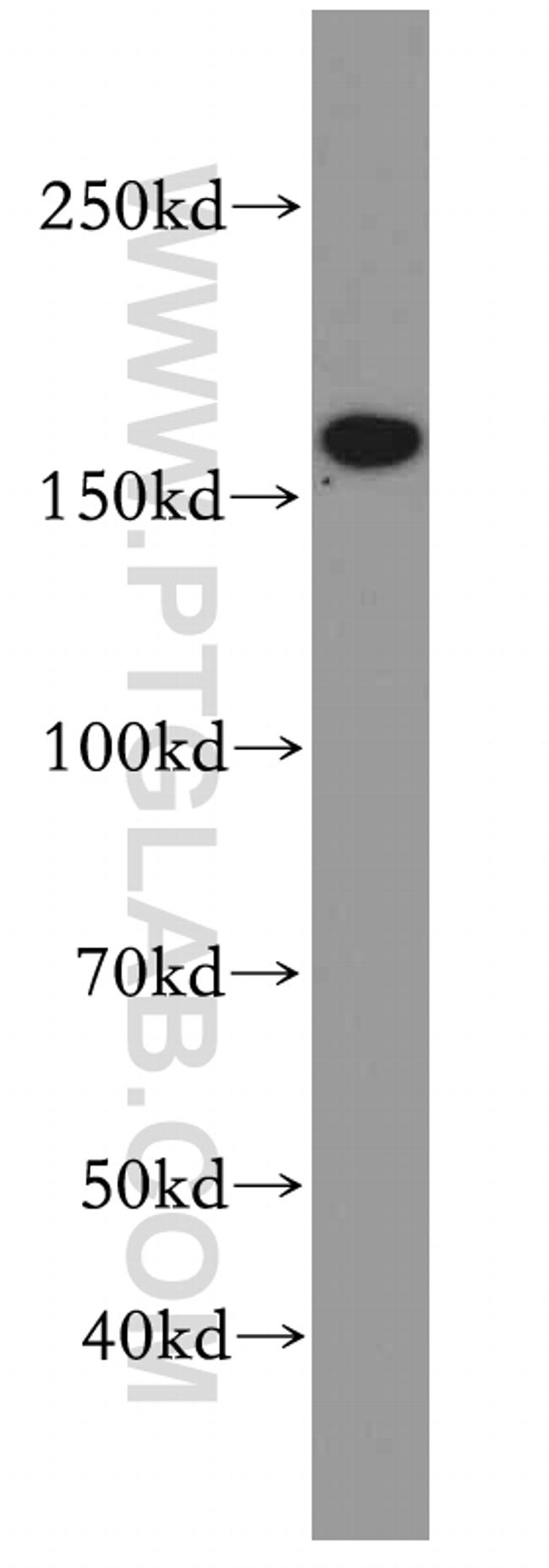 TOP2B Antibody in Western Blot (WB)