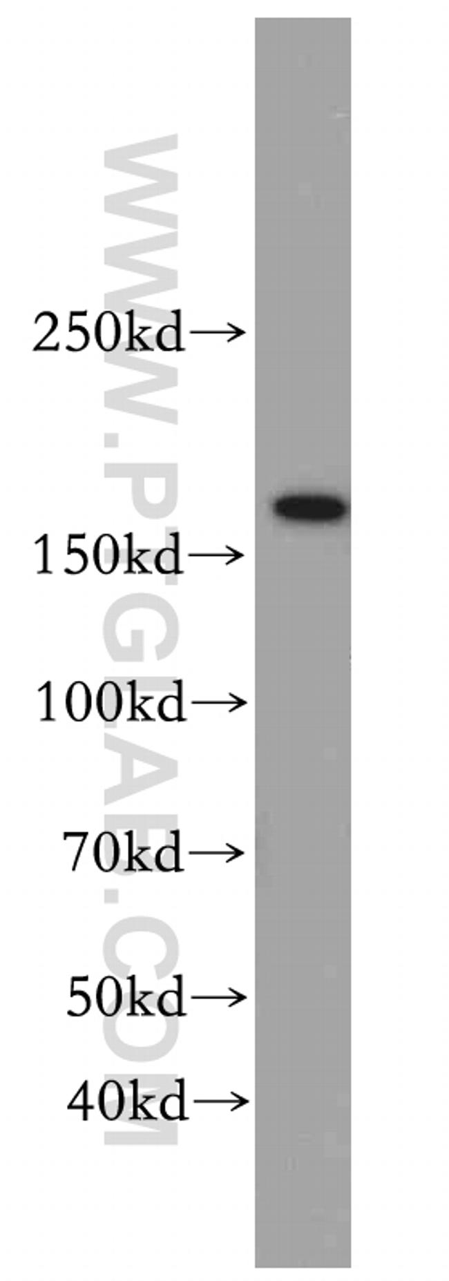 TOP2B Antibody in Western Blot (WB)