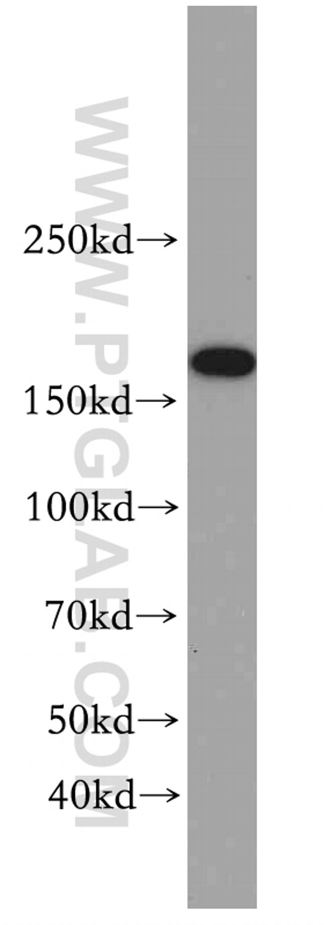 TOP2B Antibody in Western Blot (WB)