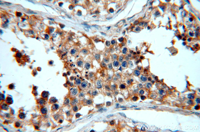 SLC16A12 Antibody in Immunohistochemistry (Paraffin) (IHC (P))